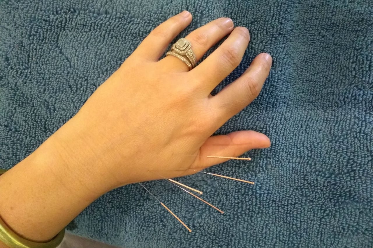 How does Dry Needling work?